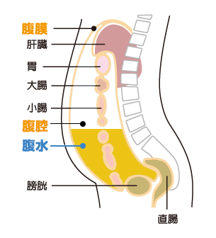 肝臓 腹水 余命