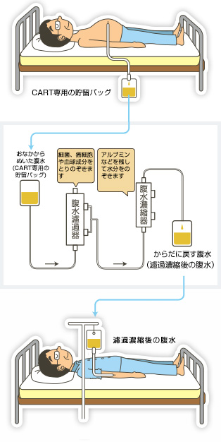 CART方法概略図